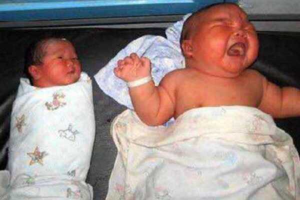 世界上最重的女婴:出生体重达13.6斤(等于普通宝宝2倍)