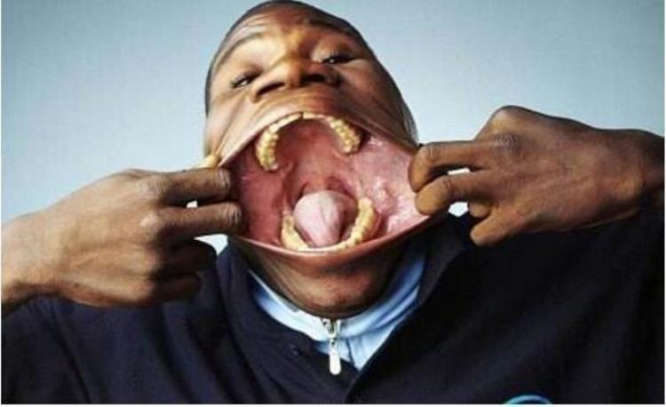 人的嘴能张多大,一般的人嘴巴可以张多大