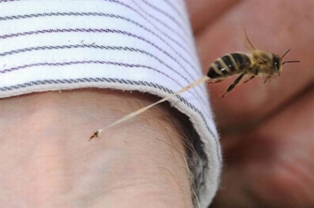蜜蜂蜇人为什么会死掉?倒刺勾住皮肤(一飞就拉出内脏)