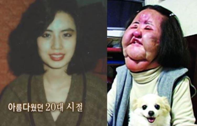 韩国整容电风扇脸,美容毁容的韩国女星