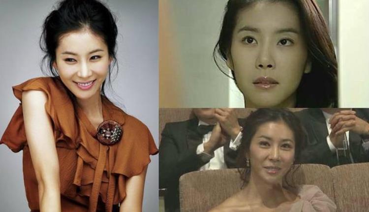 韩国女演员整容失败,韩剧整容失败案例