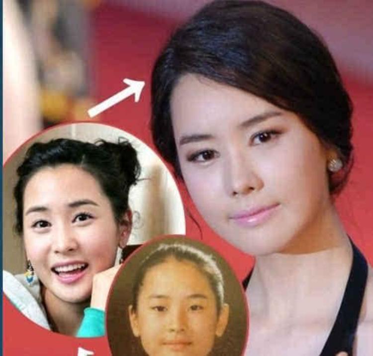 韩国女演员整容失败,韩剧整容失败案例