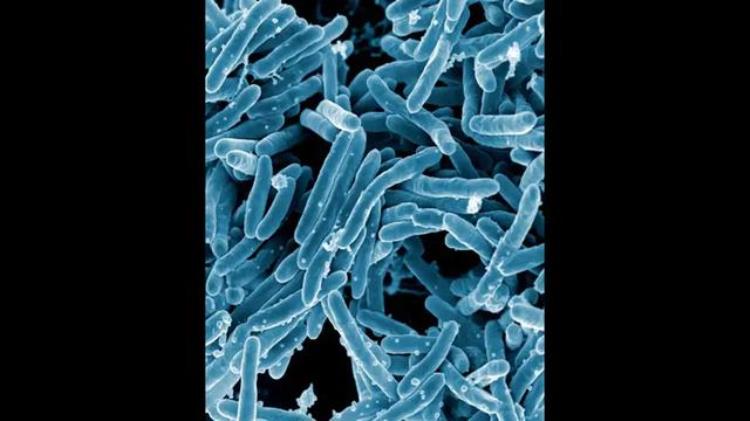 细菌武器是什么细菌,常见的致病菌是什么细菌