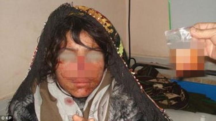 阿富汗女性被丈夫割鼻子,阿富汗老人画像