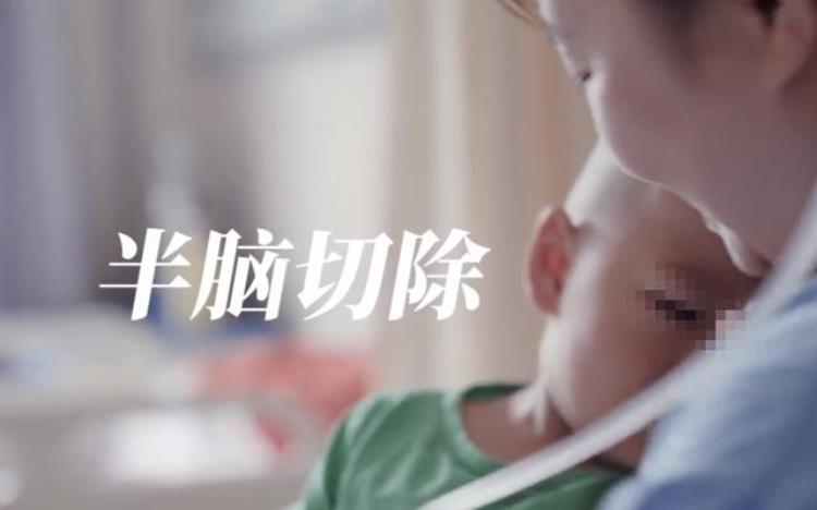 真实故事:上海2岁女童癫痫,医生告知需进行半脑切除,父母心痛难忍