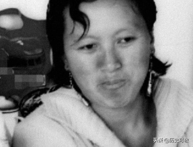 04年云南26岁女子尿血发现体内有26根缝衣针医生1岁前扎的