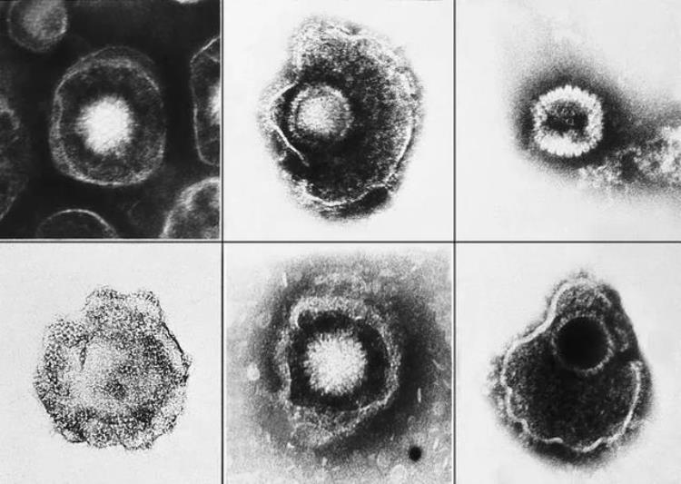 水痘痊愈后病毒会潜伏在神经吗,水痘得一次就终身免疫吗
