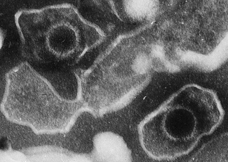 水痘痊愈后病毒会潜伏在神经吗,水痘得一次就终身免疫吗