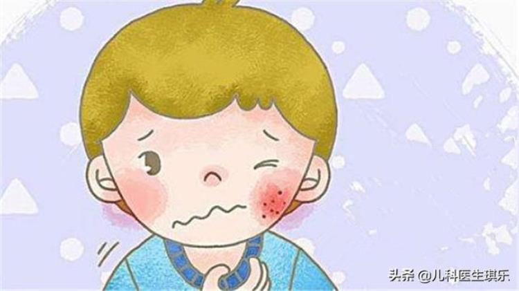 引起宝宝出现带状疱疹的原因有哪些,一岁宝宝疱疹是什么原因引起的