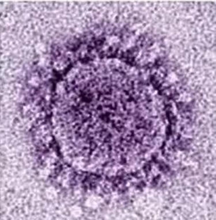 新冠状病毒为什么被医生称作流氓病毒,冠状病毒不是一般的病毒