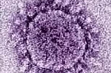 新冠状病毒为什么被医生称作流氓病毒,冠状病毒不是一般的病毒