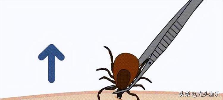 蜱虫叮咬为什么会致死,为什么蜱虫喜欢咬小孩