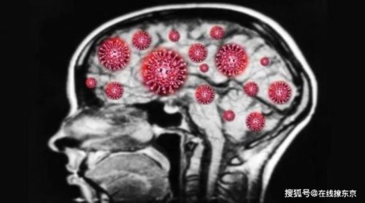专家认为新冠病毒可从鼻腔进入脑部损害神经系统的细胞,新冠病毒能穿过血脑屏障吗