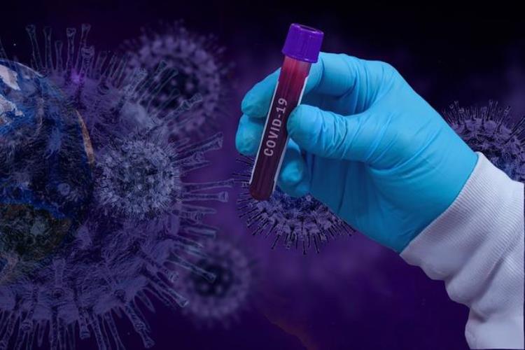科学家最新研究发现新冠病毒很可能是人工合成的这是怎么回事