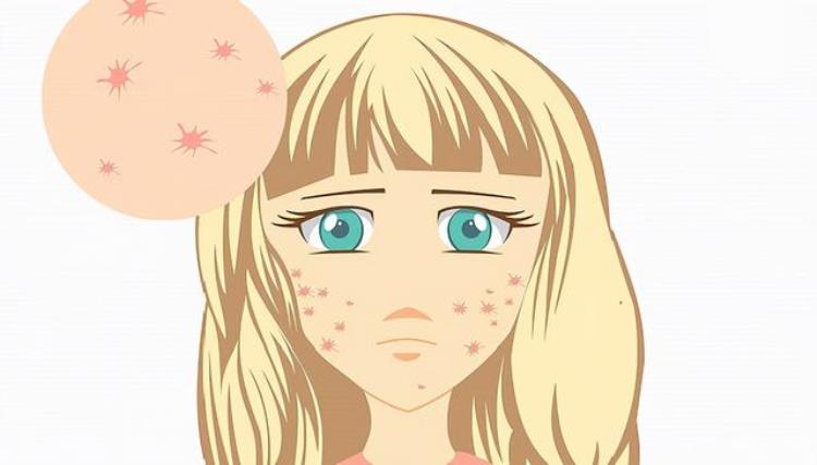 当皮肤出现红斑或者丘疹时该怎么办,全身皮肤出现红色斑丘疹