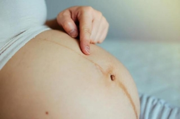 孕期为什么不能锻炼腹部,怀孕期间为什么你肚子上的妊娠线是歪的不是直的