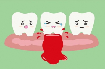 孕期牙龈为什么老出血,「口腔科普」牙龈总出血是怎么回事