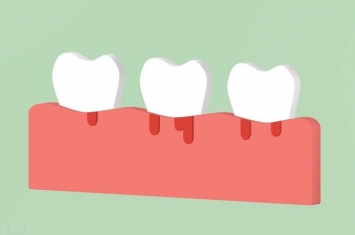 为什么孕期牙龈总是出血,可能是大病的征兆
