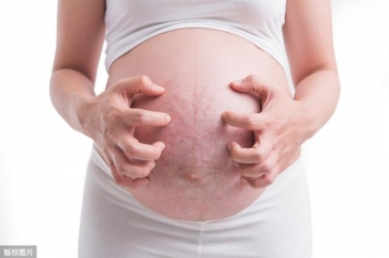 孕期为什么肚子长红点,长妊娠纹前身体会发出这几个