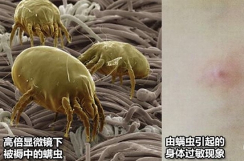 螨虫是什么?寄生在毛囊中的微型害虫(97%的人被感染)